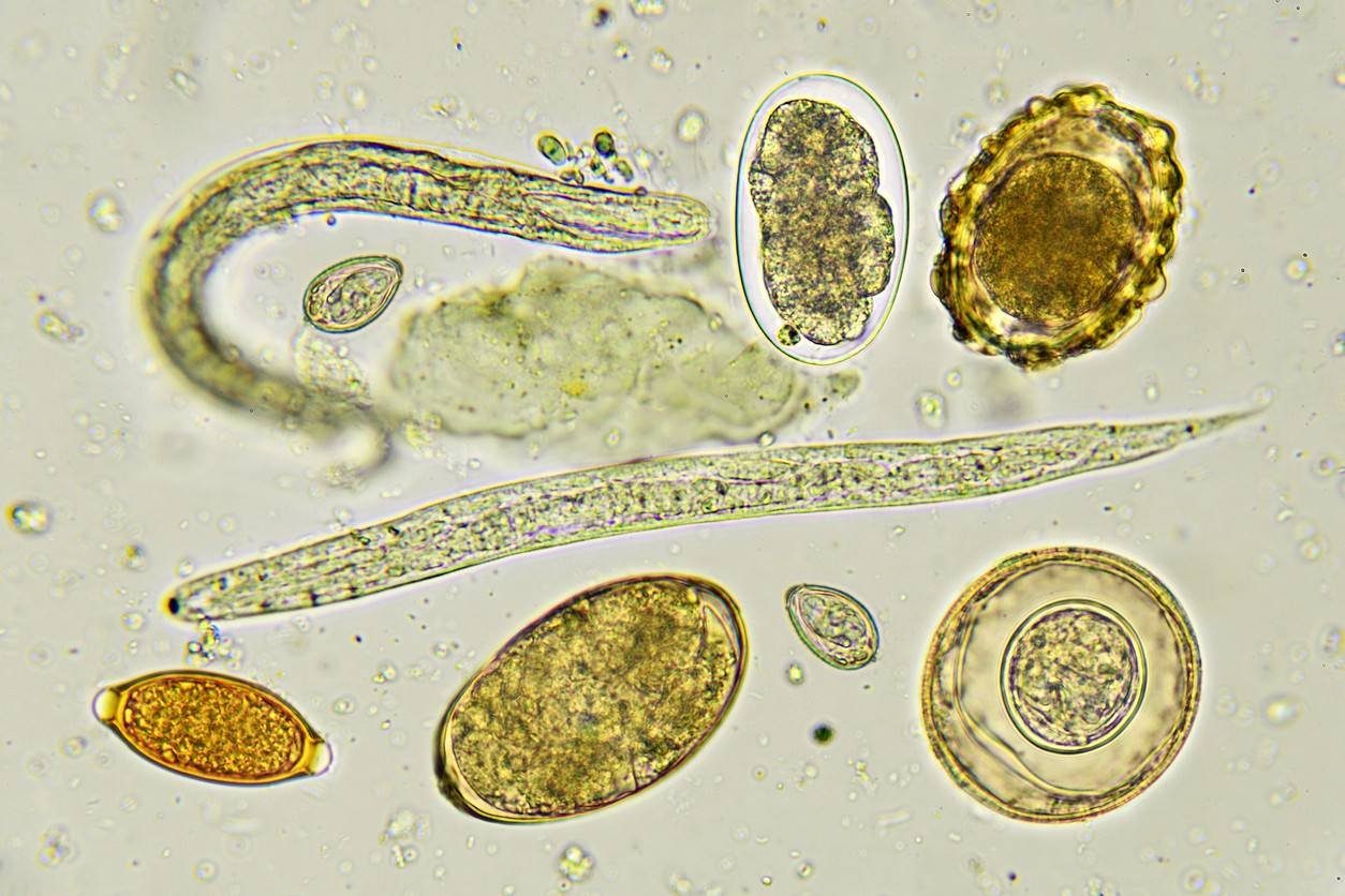 Яйца аскариды под микроскопом